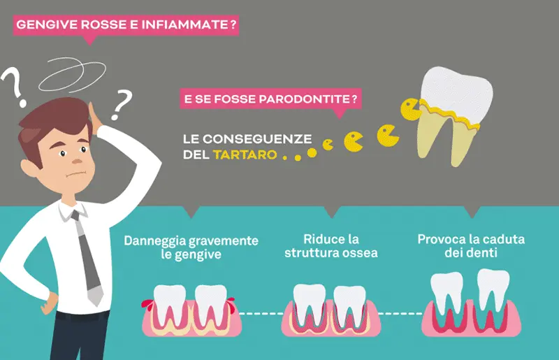 Studio Dentistico Marzulli Bari Cura Piorrea e Parodontite_1