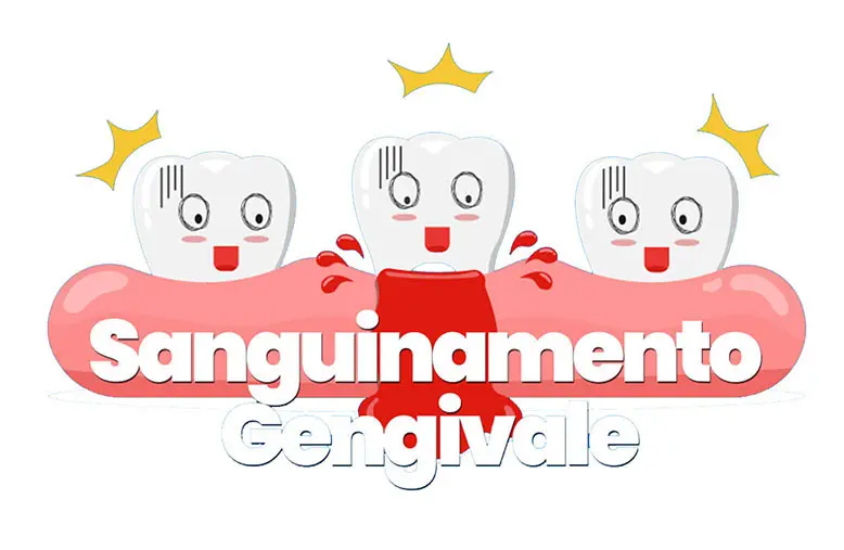 Studio Dentistico Marzulli Bari Cura Sanguinamento Gengive_1